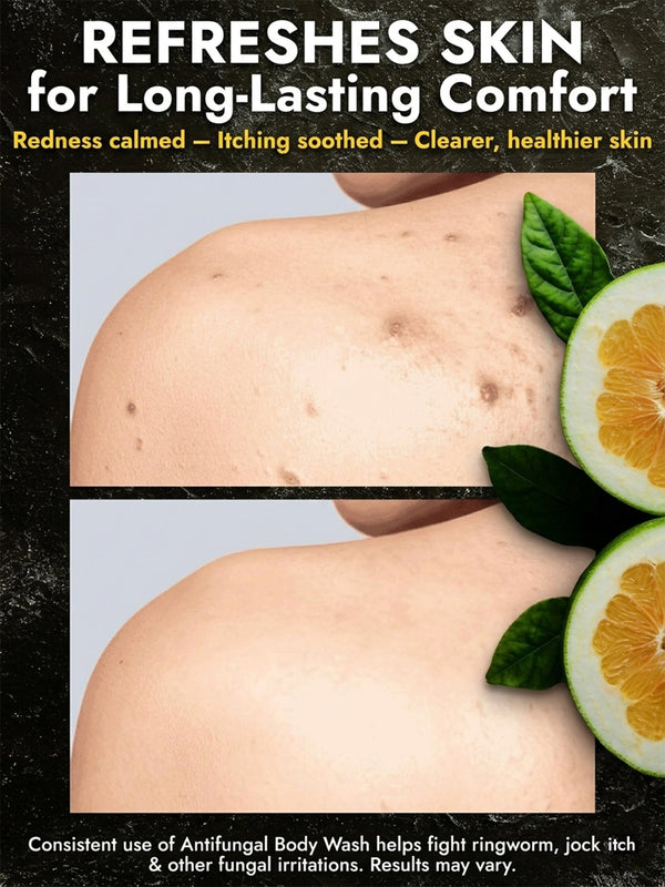 Citrus Antifungal Body Wash + Scrubber