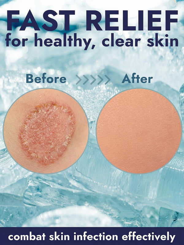 Cooling Antifungal Body Wipes - 2 Pack