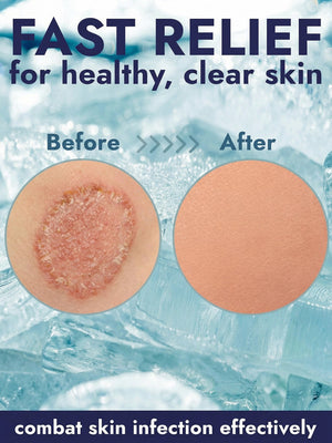 Cooling Antifungal Body Wipes