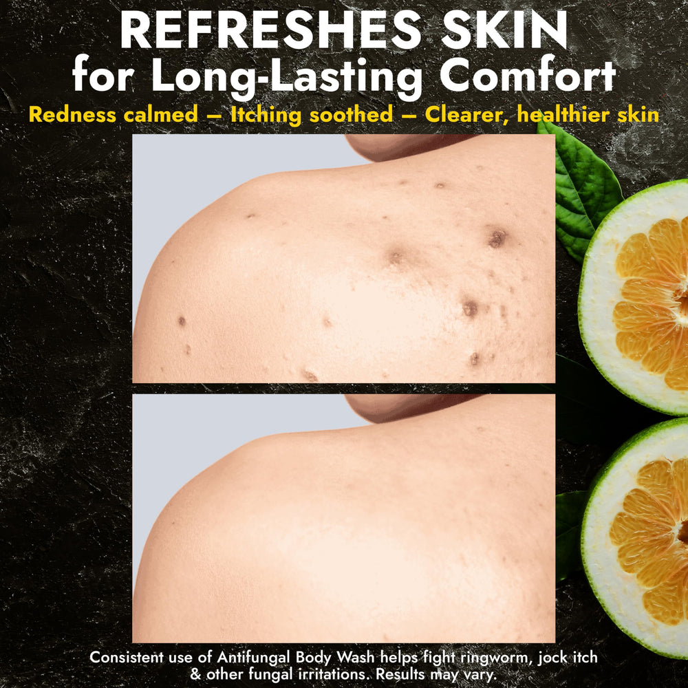 Terramed Just Think Comfort Antifungal Body Wash