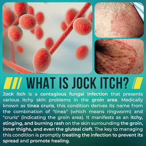 Jock Itch Cream