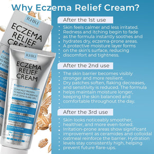 Eczema Cream