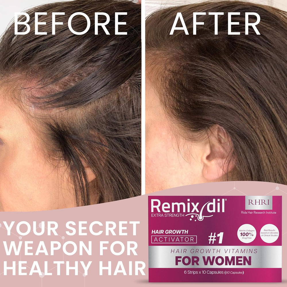 Hair Growth Vitamins