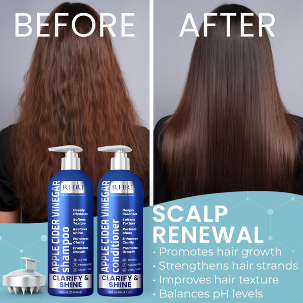 Hydrating Shampoo & Conditioner Set for Dry, Damaged & Fine Hair | Strengthen Hair Roots for Thicker, Stronger Hair, Nourishes Scalp, Reduces Breakage