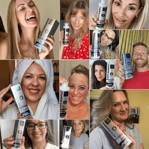 Keto Shampoo for Dandruff, Psoriasis, Folliculitis & Seborrheic Dermatitis | Anti-Fungal Itchy Scalp Relief