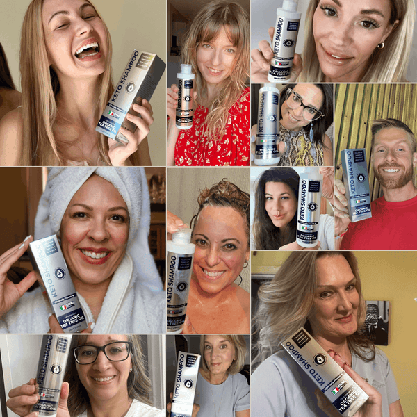 Keto Shampoo for Dandruff, Psoriasis, Folliculitis & Seborrheic Dermatitis | Anti-Fungal Itchy Scalp Relief