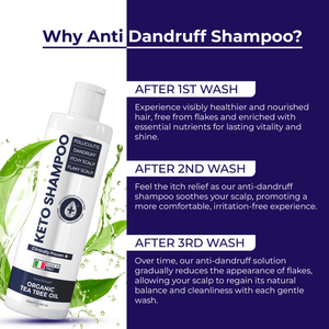 Keto Shampoo for Dandruff, Psoriasis, Folliculitis & Seborrheic Dermatitis | Anti-Fungal Itchy Scalp Relief