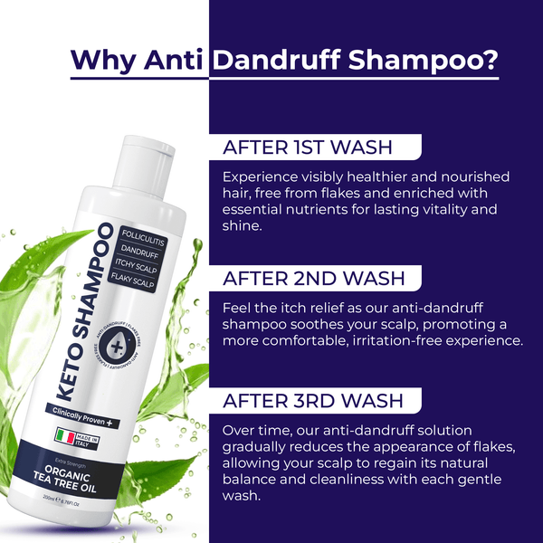 Keto Shampoo for Dandruff, Psoriasis, Folliculitis & Seborrheic Dermatitis | Anti-Fungal Itchy Scalp Relief